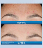 Resurfacing Retinol Serum|CERAVE