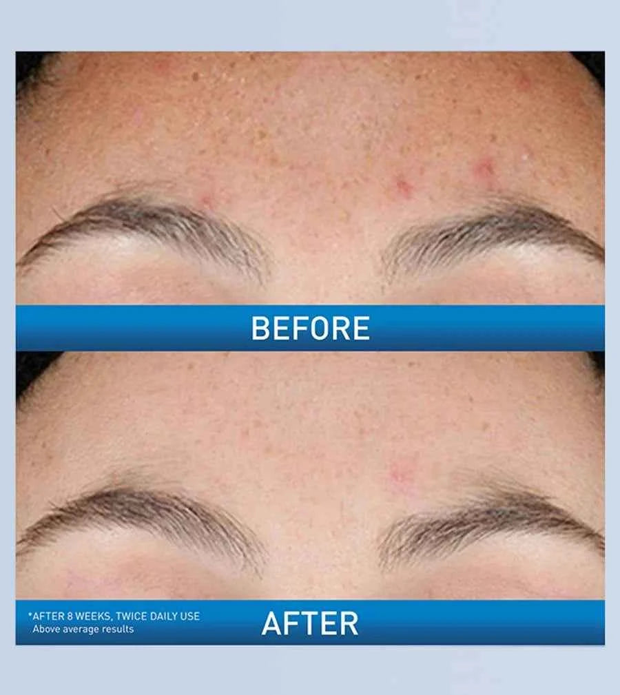 Resurfacing Retinol Serum|CERAVE