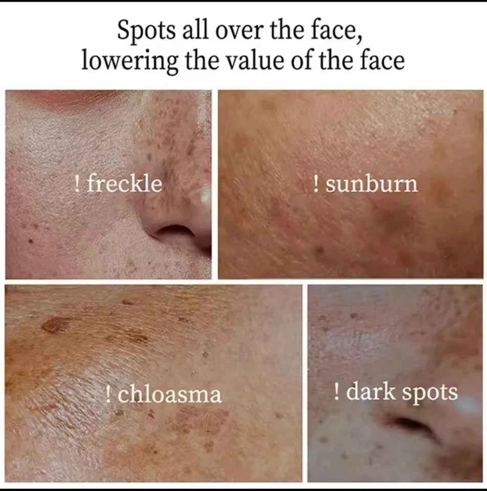 LANTHOME DARK SPOT CORRECTOR REMOVER